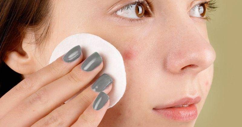 Pexels/AnnaNekrashevich